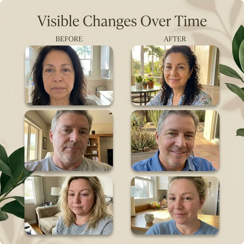 Lymphlite Face & Jawline Formula